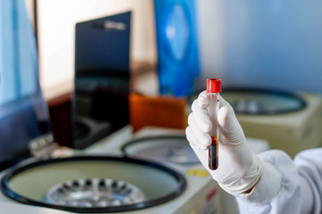Hand holding test tube with blood plasma ready for testing in laboratory