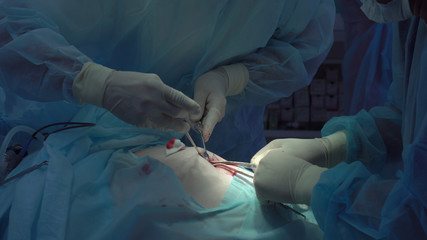 Operation using laparoscopic equipment. Surgeons team. Hospital.