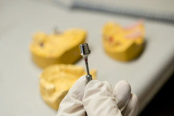 manual processing of the dental abutment close-up
