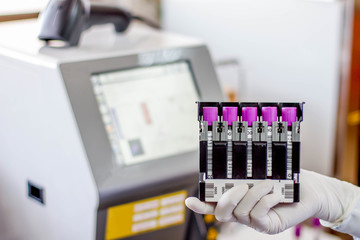 The blood in EDTA tube for test complete Blood Count (cbc) testing hematology laboratory.