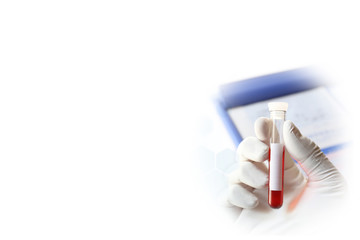 医療イメージ　血液検査