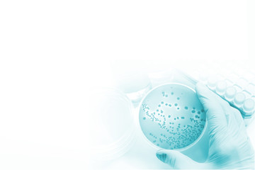 研究イメージ　微生物の鑑別