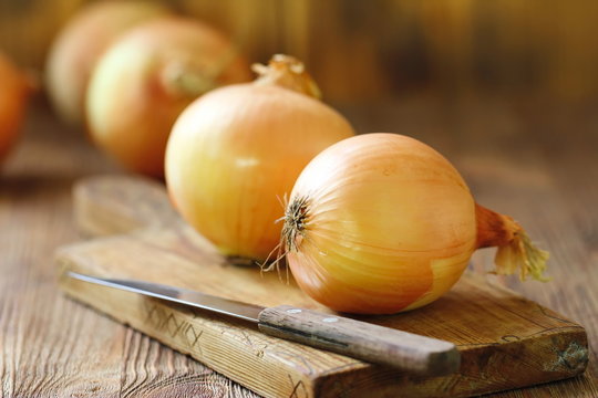 Heads Of Raw Yellow Onions