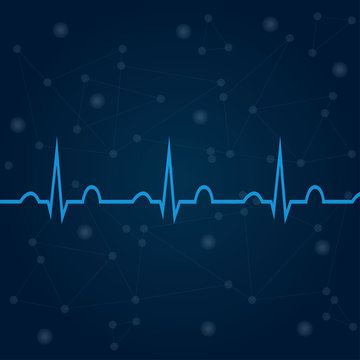 ECG on blue background with lines, dots
