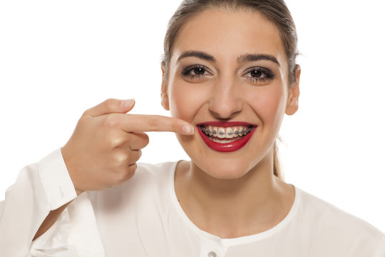 Young smiling woman pointing on her braces on white background
