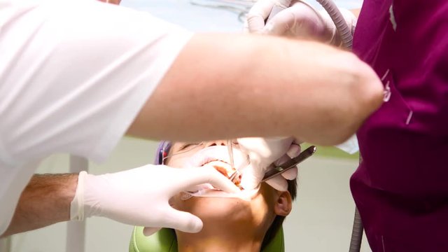 A dentist produces a wisdom tooth extraction to a young woman. Dental treatment