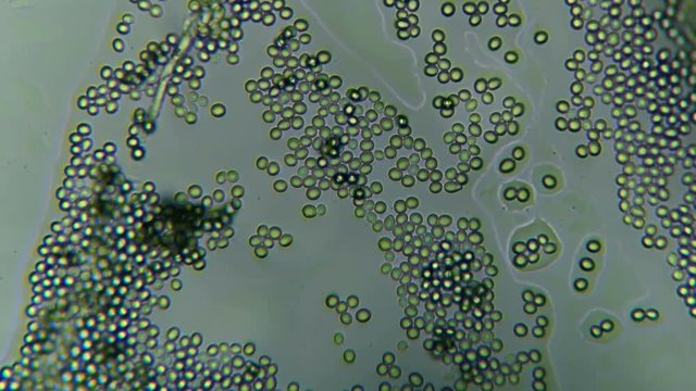 Mold Formed On Old Bread Under A Microscope