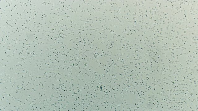 the movement of the sperm under a microscope