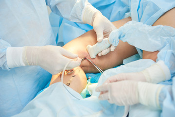 Surgery of varix vein