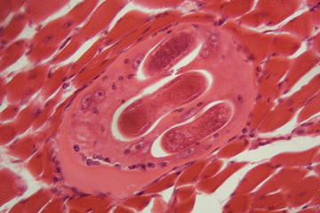 Obraz na płótnie Canvas Trichinella spiralis larvae in muscle tissue under the microscope.