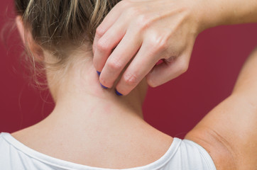 Ótimo conceito de alergia, coceira no corpo, mulher coçando parte do corpo