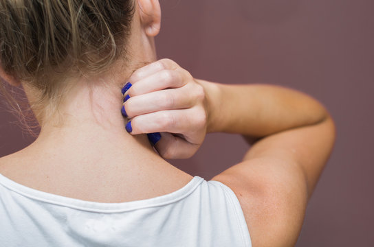 &Oacute;timo conceito de alergia, coceira no corpo, mulher co&ccedil;ando parte do corpo