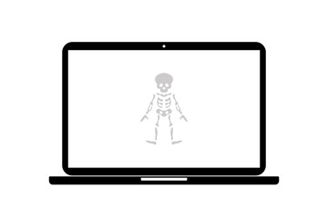 Laptop - Skelett