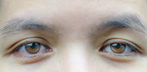 Macro shot of Asian middle aged woman brown eyes with wrinkles under the eyes and showing veins in...