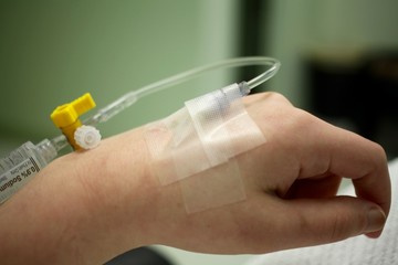 Close up of an IV needle in a patients hand at the hospital