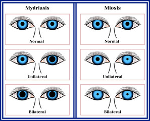 Mydriasis - expansion of a pupil. Miosis - narrowing of a pupil.