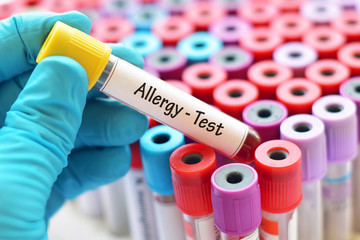 Test tube with blood sample for allergy test