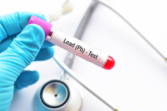 Test tube with blood sample for lead (Pb) test