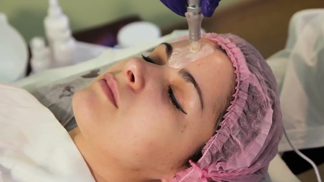 The young woman's face during the procedure closeup. Innovative cosmetic procedure. Medical procedure rejuvenation.