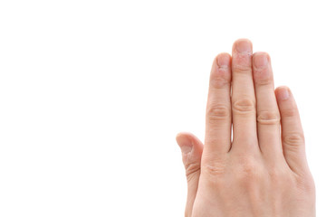 Bitten fingers close-up on a white background. Terribly badly bitten fingers of a hand. Stress....