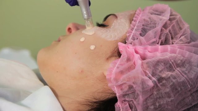 Meso glow bb procedure. The hands of the beautician apply the medication on the patient's face. Medical procedure rejuvenation.