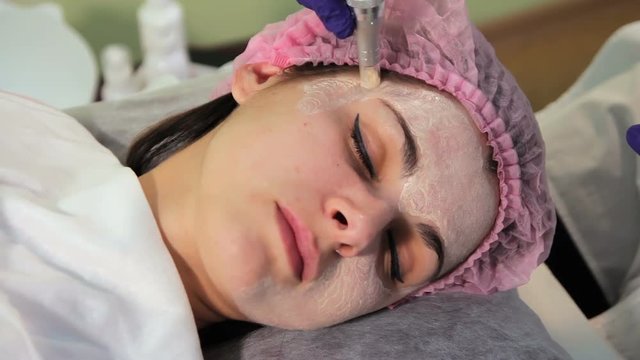 The young woman's face during the procedure closeup. Innovative cosmetic procedure. Medical procedure rejuvenation. Electrical dermapen