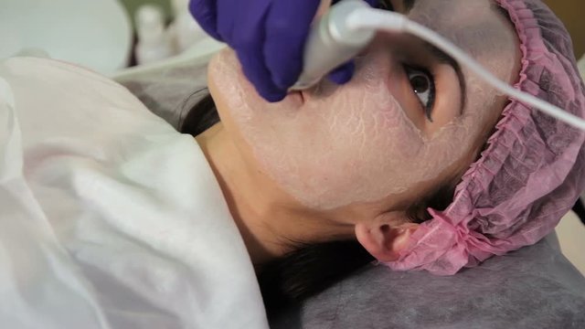 The young woman's face during the procedure closeup. Innovative cosmetic procedure. Medical procedure rejuvenation. Electrical dermapen. The woman pursed her lips