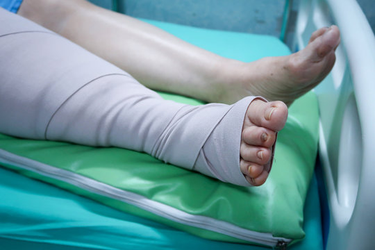 Leg with bandage after surgical operation