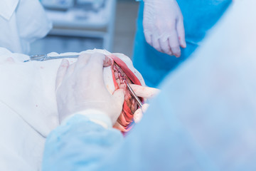Fototapeta premium the hands of a surgeon's doctor sewing up the cut of the skin after an operation to remove the atheroma on the patient's head in the hospital. concept photo of professional doctors, painless medicine