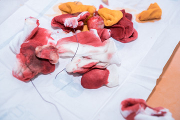 used gauze tampons, with traces of blood lying in a heap, after surgery, medical supplies in the operating room of the clinic