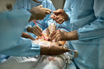 Abdominal operation process