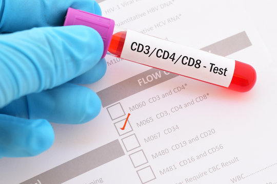 Blood sample for CD3/CD4/CD8 test