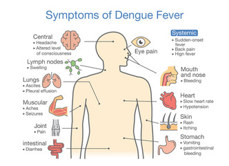 Symptoms of Dengue Fever patient. Illustration about diagram for health check up.