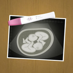 echography of twins and test pregnancy