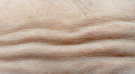 Macro shot detail of forehead wrinkles from emotional expression. Collagen and botox face injections concept. Dry forehead of face skin of menopause woman