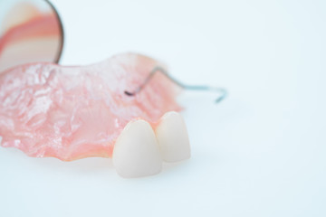 Dental prosthetic isolatic - partial denture upper side.