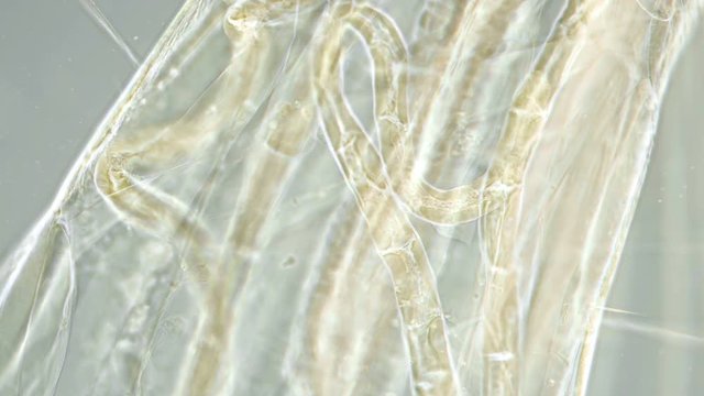 a transparent larva under the microscope,with internal organs,like an alien organism