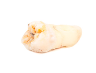 Human tooth
