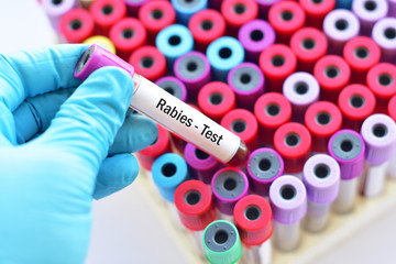 Fototapeta premium Blood sample for rabies virus test