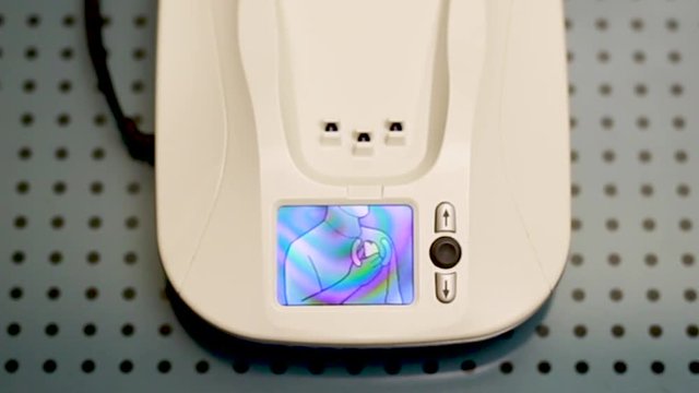 A patient with cardio heart bit problem uses an insertable device that continuously monitors heart rhythms, records and wirelessly sends the data to the DR.