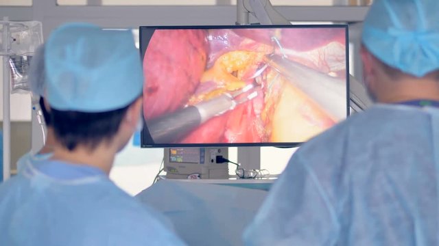 Doctors perfom surgery using robotic medical equipment. Monitor shows procedure in background.