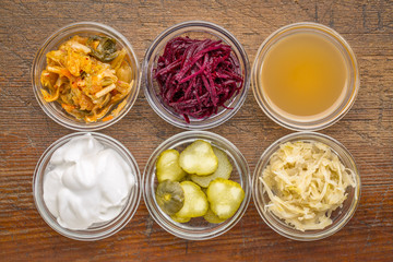 fermented food sampler