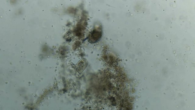 transparent microorganism under the microscope, with internal organs, as is an alien organism