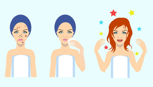 acne treatment before after, vector illustration