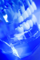 Fototapeta na wymiar Dental alignment teeth model