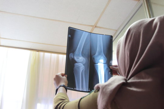 close up of woman doctor holding x-ray or roentgen image