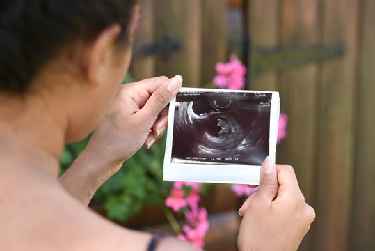 Examen échographique du fœtus d'une femme enceinte. Appareil d'échographie.  Scanner à ultrasons Photo Stock - Alamy