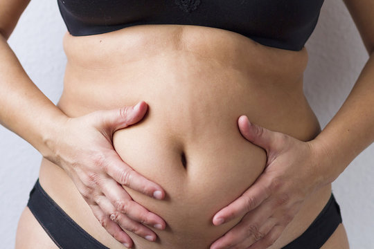 Woman's fat belly