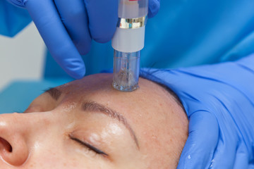 Cosmetic treatment by injection in the clinic. Use of a dermal injector to stimulate the skin. A...