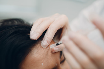 Woman getting lifting botox injection in forehead. Close-up woman hyaluronic acid injection. Botox...